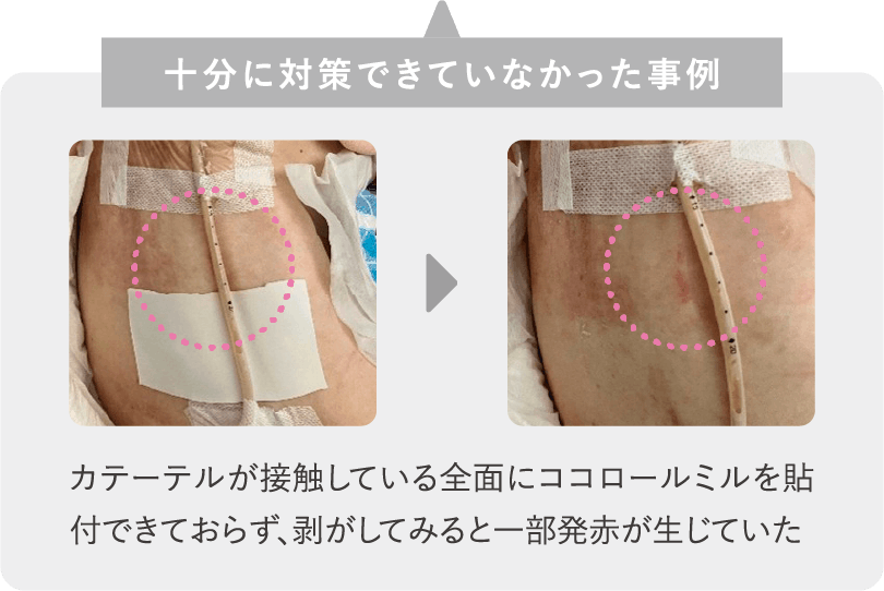 十分に対策できていなかった事例