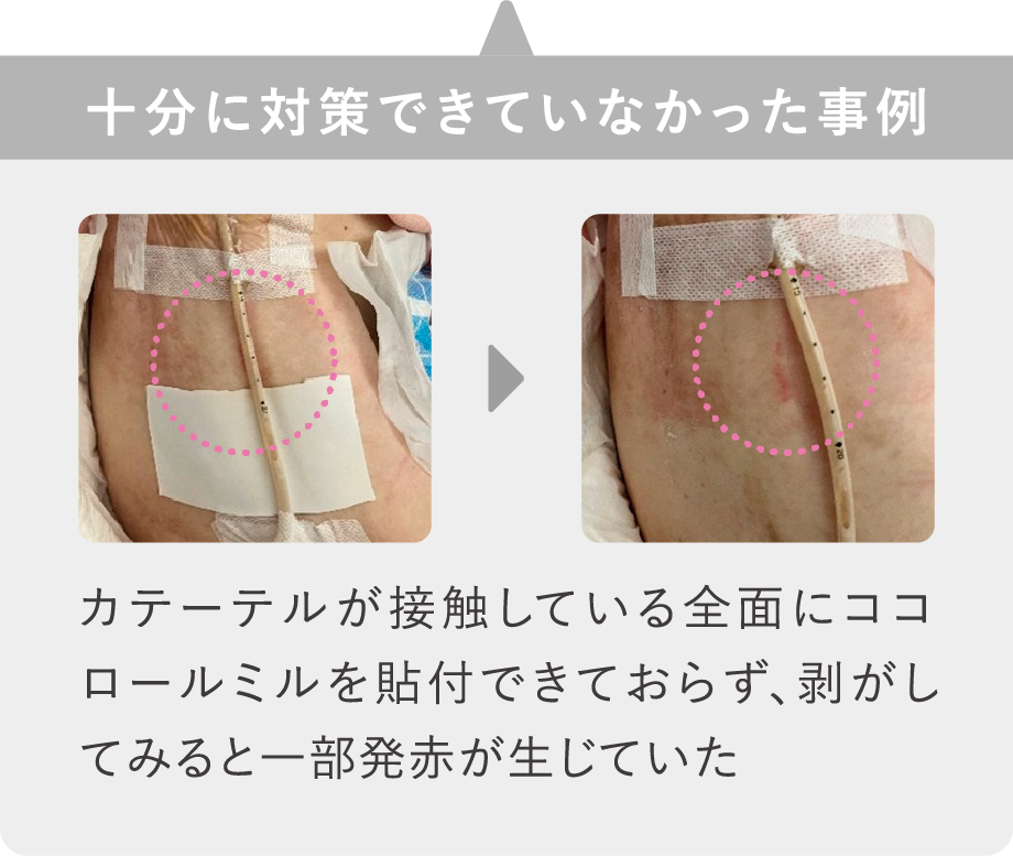 十分に対策できていなかった事例