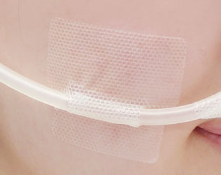 栄養チューブのほほでのルート固定に（ほほテープ）