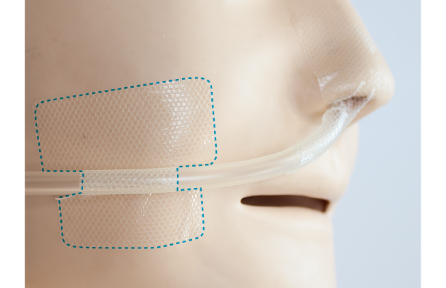 上手な経鼻チューブの固定方法（ほほ）｜クリアホールド貼り方・はがし方ガイド（写真・動画付き）の画像