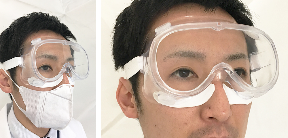 感染対策用のゴーグルで圧迫される頬のMDRPU予防