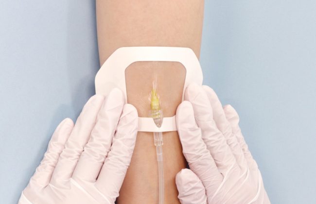 末梢静脈カテーテル固定フィルムのわかりやすい貼り方【エアウォールIV　フレームタイプ】の画像