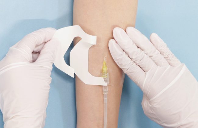 末梢静脈カテーテル固定フィルムのわかりやすい貼り方【エアウォールIV　フレームタイプ】の画像