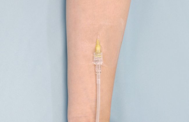 末梢静脈カテーテル固定フィルムのわかりやすい貼り方【エアウォールIV　フレームタイプ】の画像