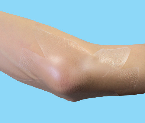 はがれにくくなる  肘へのフィルムドレッシングの貼り方の画像