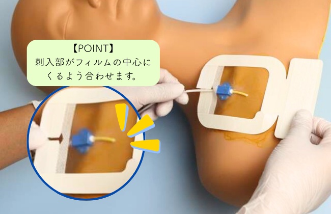 中心静脈カテーテル固定フィルムのわかりやすい貼り方【エアウォールIV切り込みタイプ】の画像