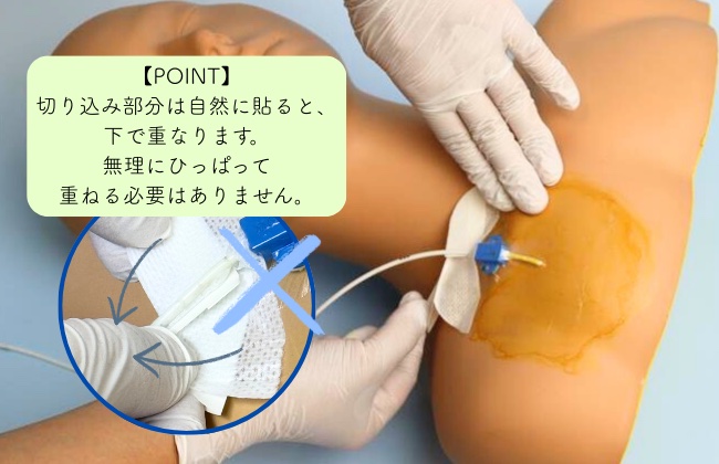 中心静脈カテーテル固定フィルムのわかりやすい貼り方【エアウォールIV切り込みタイプ】の画像