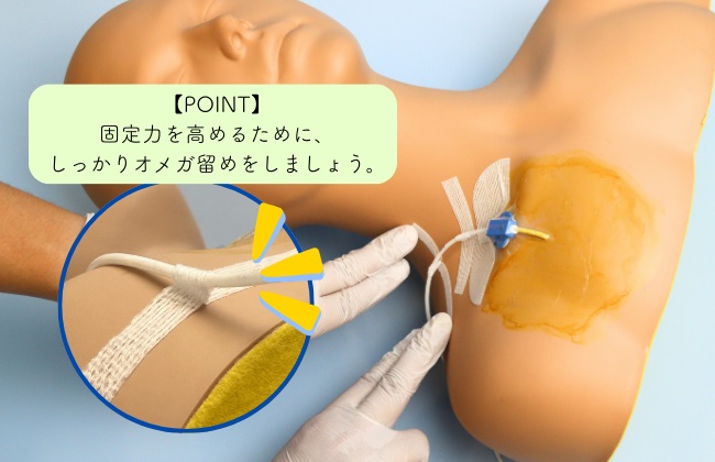 中心静脈カテーテル固定フィルムのわかりやすい貼り方【エアウォールIV切り込みタイプ】の画像