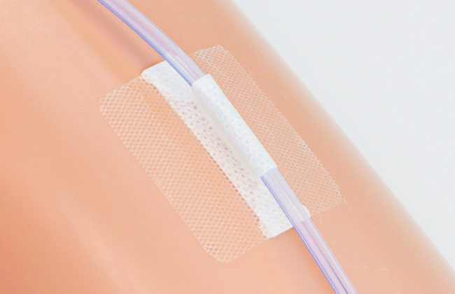 尿道カテーテル・ドレーンチューブ固定テープのわかりやすい貼り方・はがし方【クリアホールドライナー】の画像