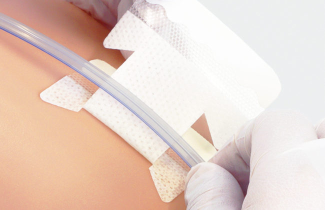 尿道カテーテル・ドレーンチューブ固定テープのわかりやすい貼り方・はがし方【クリアホールドライナー】の画像