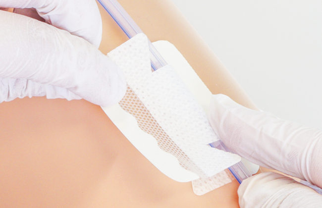 尿道カテーテル・ドレーンチューブ固定テープのわかりやすい貼り方・はがし方【クリアホールドライナー】の画像