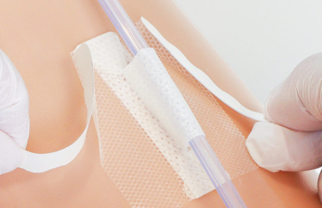 尿道カテーテル・ドレーンチューブ固定テープのわかりやすい貼り方・はがし方【クリアホールドライナー】の画像