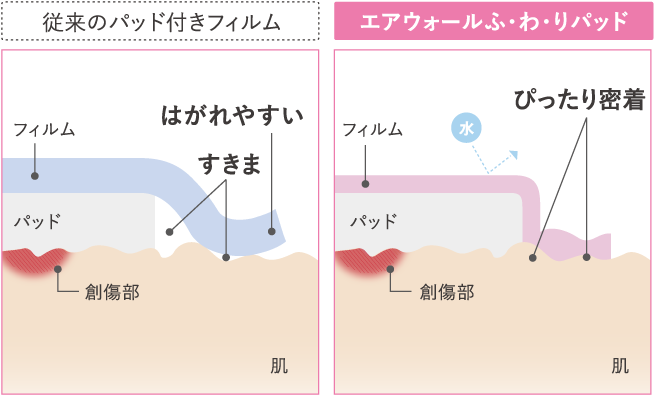 ぴったり密着、しっかりガード