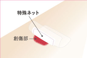 ●傷につきにくい表面加工