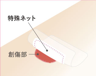 ●傷につきにくい表面加工