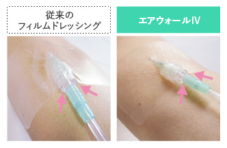 エアウォールIV｜製品ページ｜skinix（スキニックス）