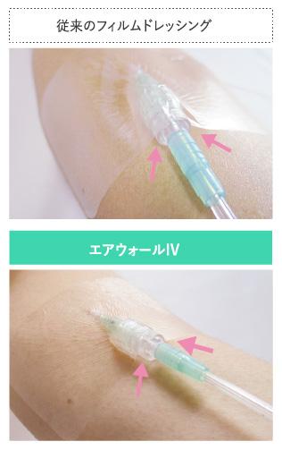 エアウォールIV｜製品ページ｜skinix（スキニックス）