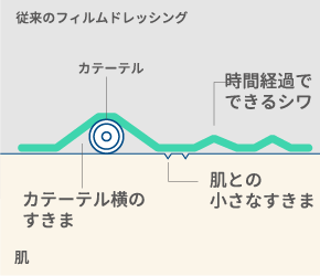 菌の侵入経路