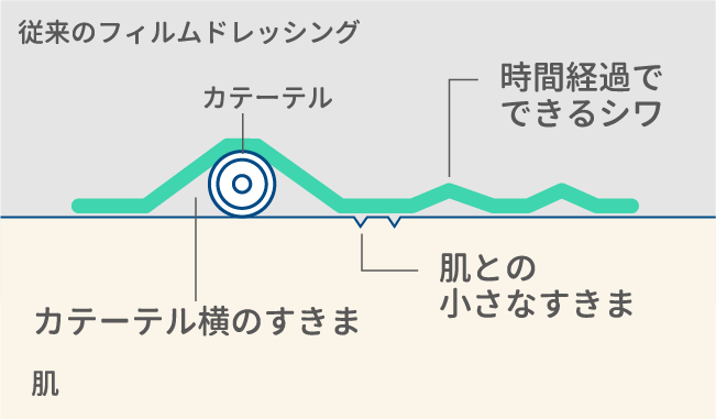 菌の侵入経路