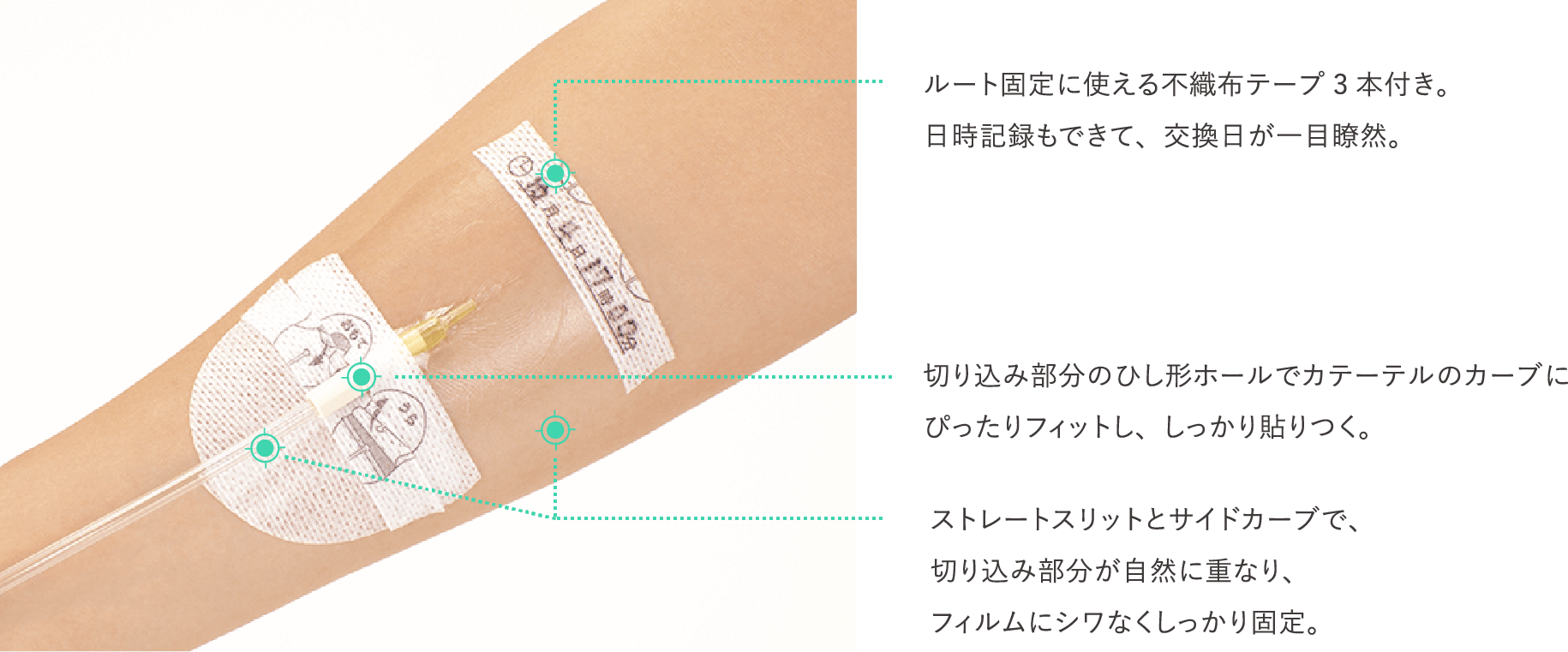 ルートもがっちり固定「切り込みタイプ」