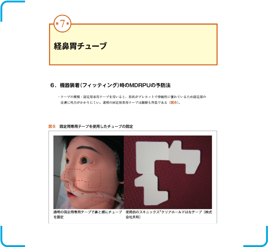 MDRPUのベストプラクティス