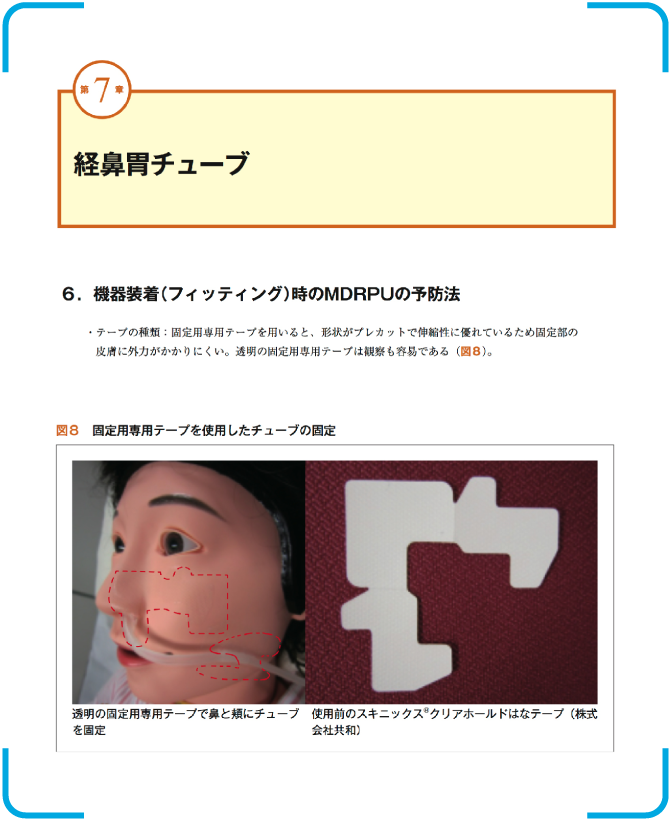 MDRPUのベストプラクティス