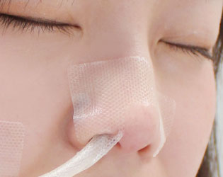 鼻から挿入する栄養チューブの鼻部分の固定に（はなテープ）