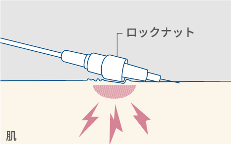 ●ココロール カテ用　なし