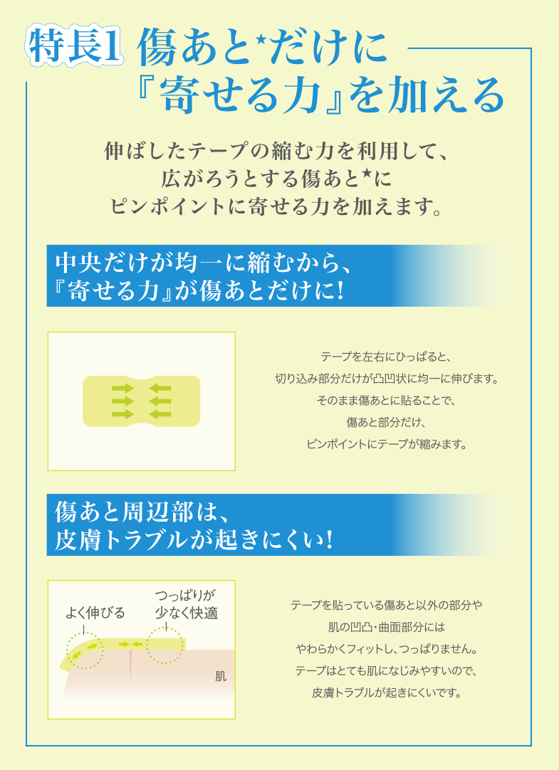 アトレスケア 公式 帝王切開などの抜糸後 貼って寄せる傷あとケア専用テープ