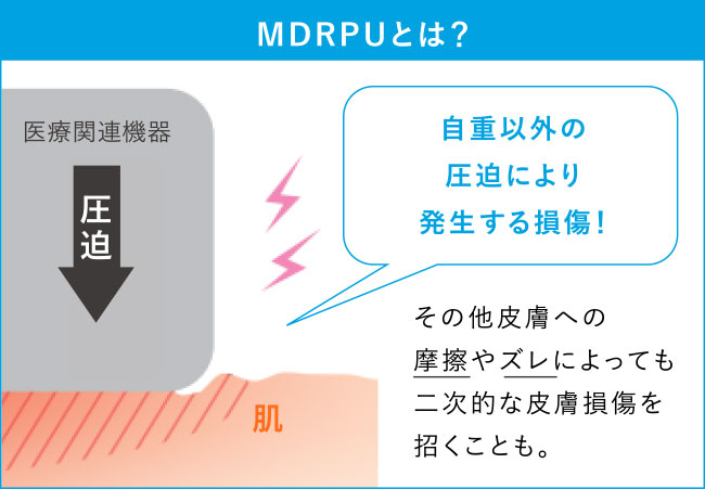 MDRPUとは？