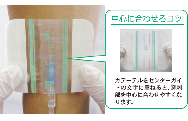 末梢静脈カテーテル固定フィルムのわかりやすい貼り方【エアウォールIV　レギュラータイプ】の画像