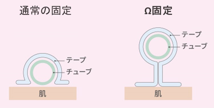 記事中イラストΩ固定